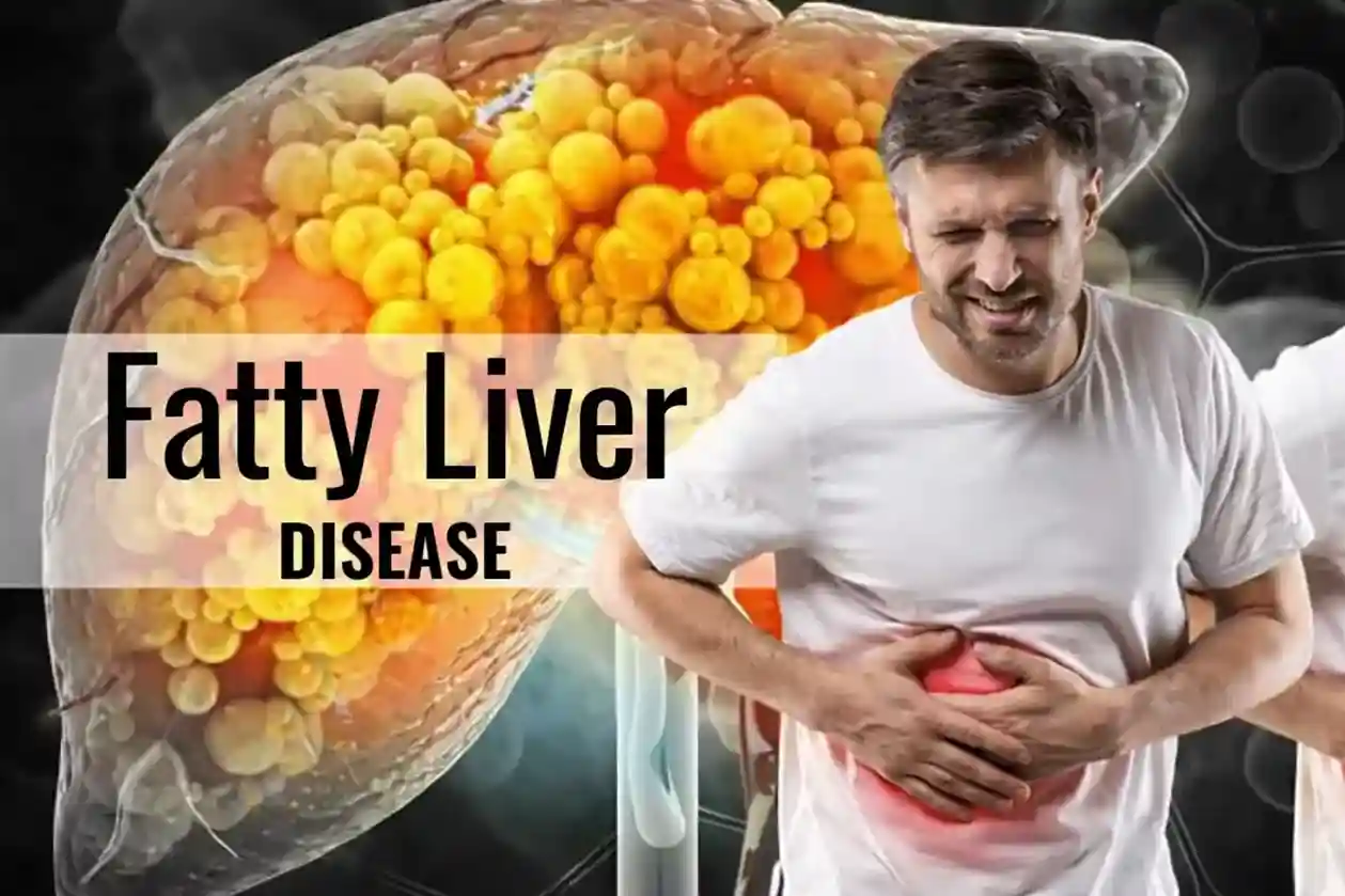 fatty-liver-disease-the-silent-killer