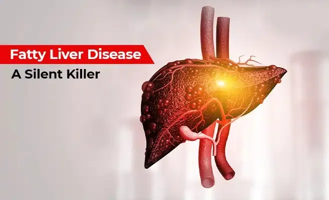fatty-liver-disease-the-silent-killer