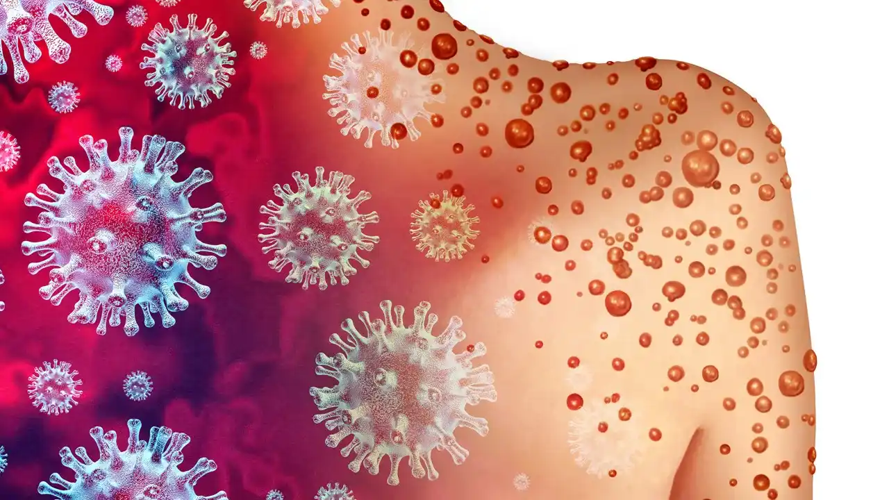 hormonal-disorders-and-signs-on-the-skin