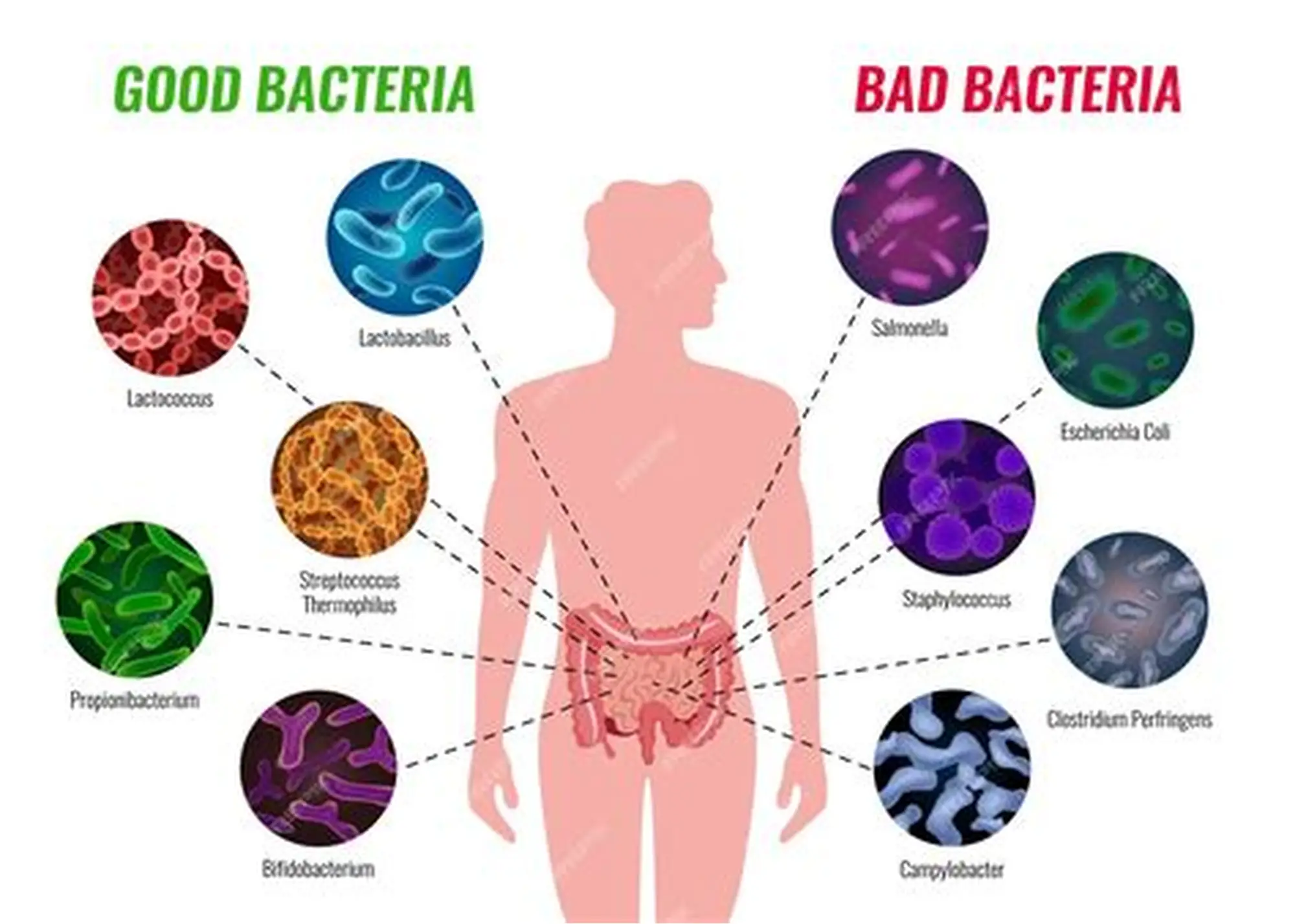 you-are-lacking-beneficial-bacteria-without-knowing-it